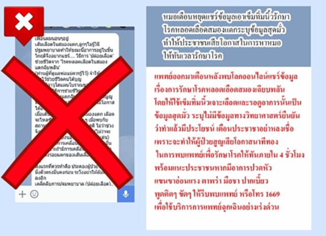 หมอเตือนโลกออนไลน์แชร์การรักษาโรคหลอดเลือดสมองเฉียบพลันสุดมั่ว หมอเตือนโลกออนไลน์แชร์การรักษาโรคหลอดเลือดสมองเฉียบพลันสุดมั่ว