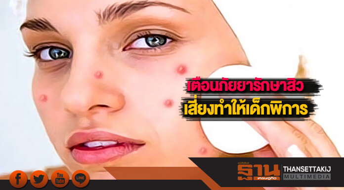 เตือนภัยยารักษาสิวเสี่ยงทำให้เด็กพิการ