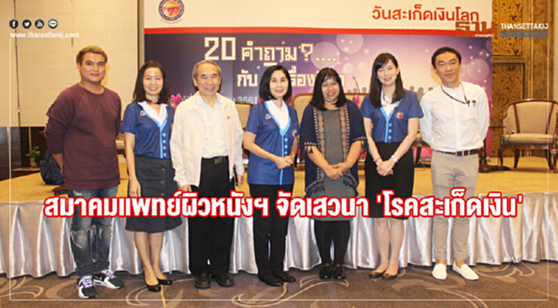 สมาคมแพทย์ผิวหนังฯ จัดเสวนา 'โรคสะเก็ดเงิน' สมาคมแพทย์ผิวหนังฯ จัดเสวนา 'โรคสะเก็ดเงิน'