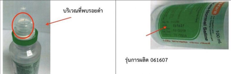 อย.แจงเรียกคืนน้ำเกลือ หลังพบรอยดำที่ปากขวด 