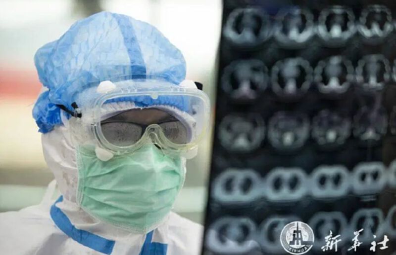 ผลชันสูตรเหยื่อโคโรนา พบเชื้อ "กลายพันธุ์ในปอด" ผลชันสูตรเหยื่อโคโรนา พบเชื้อ "กลายพันธุ์ในปอด"