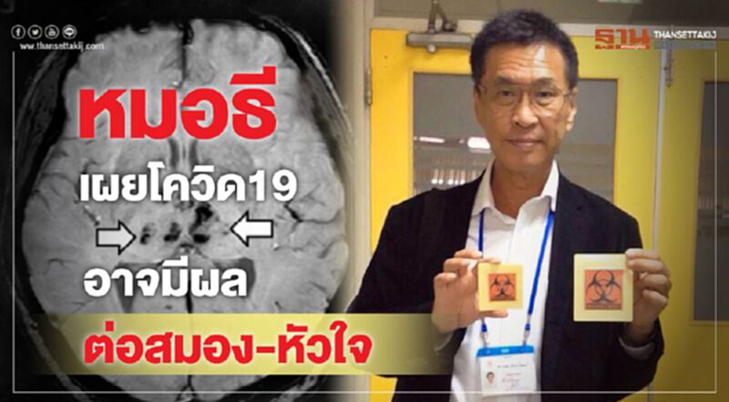 หมอธีเผยโควิด19 อาจมีผลต่อสมอง-หัวใจ หมอธีเผยโควิด19 อาจมีผลต่อสมอง-หัวใจ