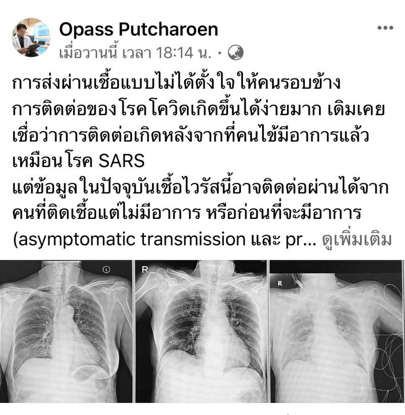กลับต่างประเทศไม่กักตัว ทำแม่อาการหนักติดโควิด-19 