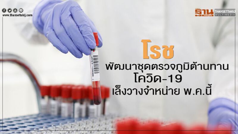 โรช พัฒนาชุดตรวจภูมิต้านทานโควิด-19 เล็งวางจำหน่าย พ.ค.นี้ โรช พัฒนาชุดตรวจภูมิต้านทานโควิด-19 เล็งวางจำหน่าย พ.ค.นี้