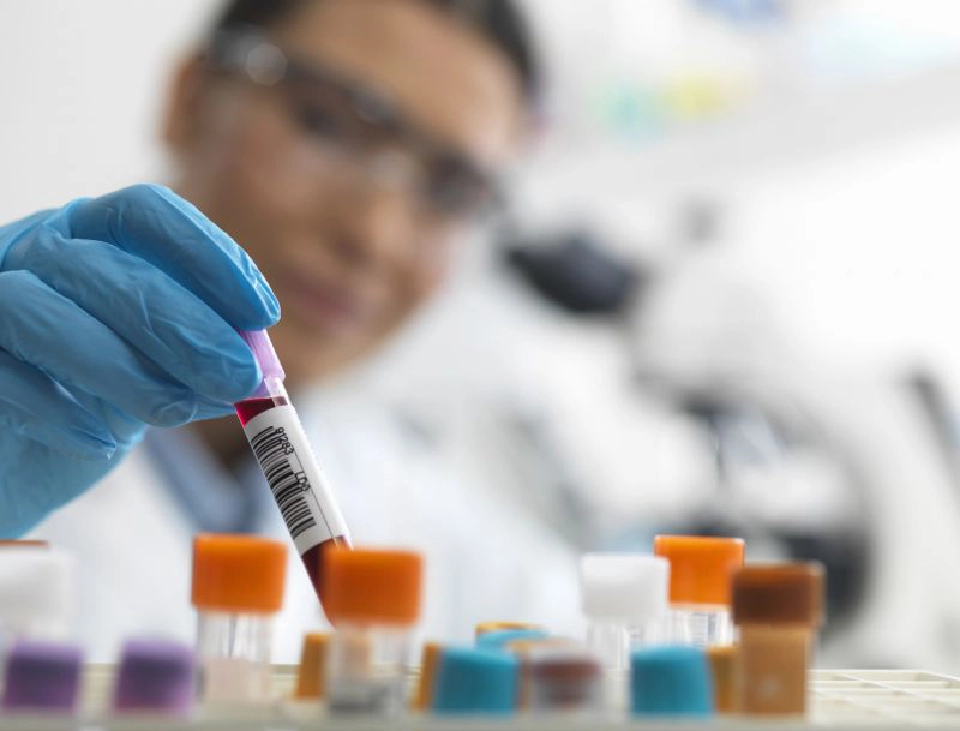 อย.สหรัฐเตือนผู้ป่วยโควิด ผลข้างเคียง “คลอโรควิน” ถึงตาย