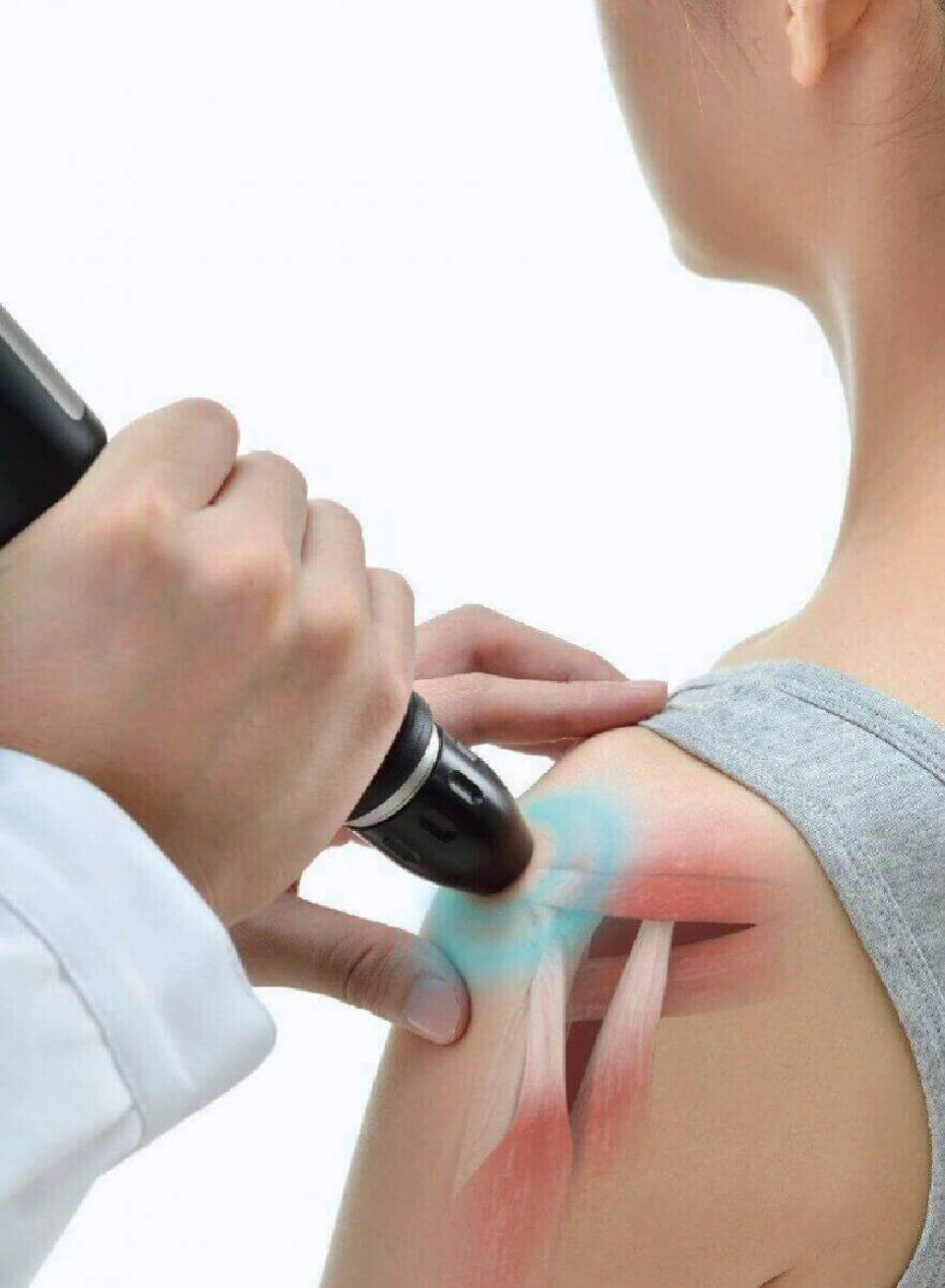 เตือนปวดไหล่ยกแขนไม่สุดสัญญาณกระดูกงอกทับเอ็นข้อไหล่