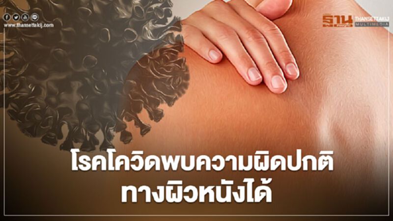โรคโควิด-19พบความผิดปกติทางผิวหนังได้ โรคโควิด-19พบความผิดปกติทางผิวหนังได้