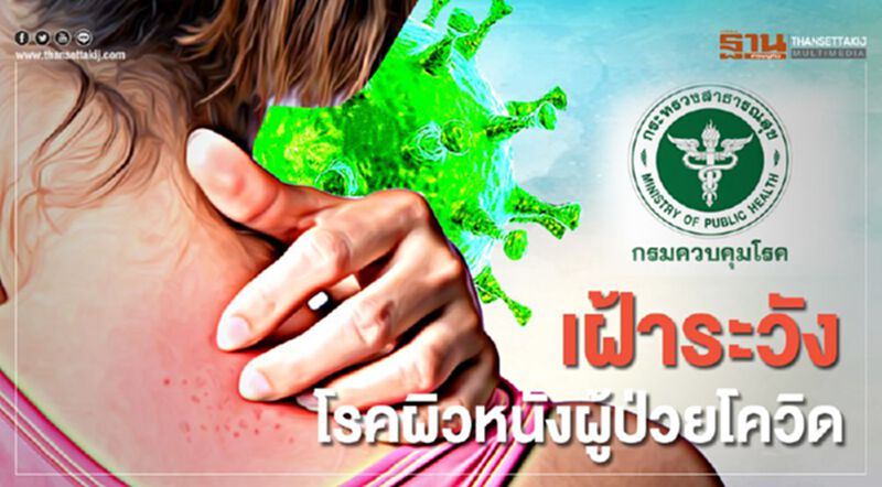 ไทยเฝ้าระวังโรคผิวหนังบริเวณนิ้วเท้าผู้ป่วยโควิด-19 ไทยเฝ้าระวังโรคผิวหนังบริเวณนิ้วเท้าผู้ป่วยโควิด-19