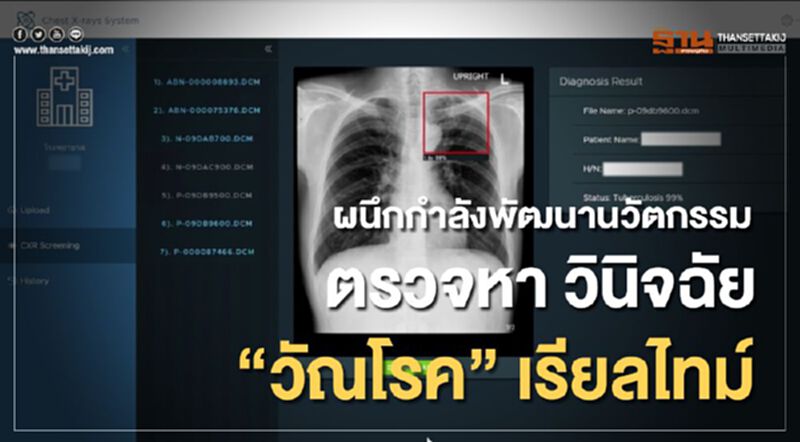 ผนึกกำลังพัฒนานวัตกรรม ตรวจหา วินิจฉัย "วัณโรค" เรียลไทม์ ผนึกกำลังพัฒนานวัตกรรม ตรวจหา วินิจฉัย "วัณโรค" เรียลไทม์