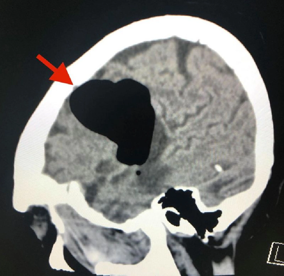 "หมอมนูญ"เตือนห้ามปิดจมูกและปากขณะจามเด็ดขาด