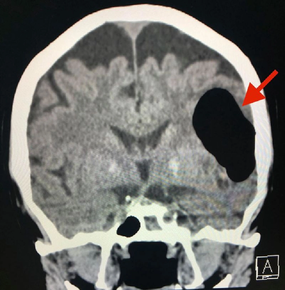 "หมอมนูญ"เตือนห้ามปิดจมูกและปากขณะจามเด็ดขาด