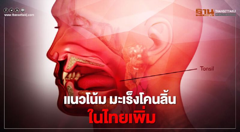 รู้จัก“มะเร็งโคนลิ้น”ที่คร่าชีวิต"ไกรศักดิ์ ชุณหะวัณ " รู้จัก“มะเร็งโคนลิ้น”ที่คร่าชีวิต"ไกรศักดิ์ ชุณหะวัณ "