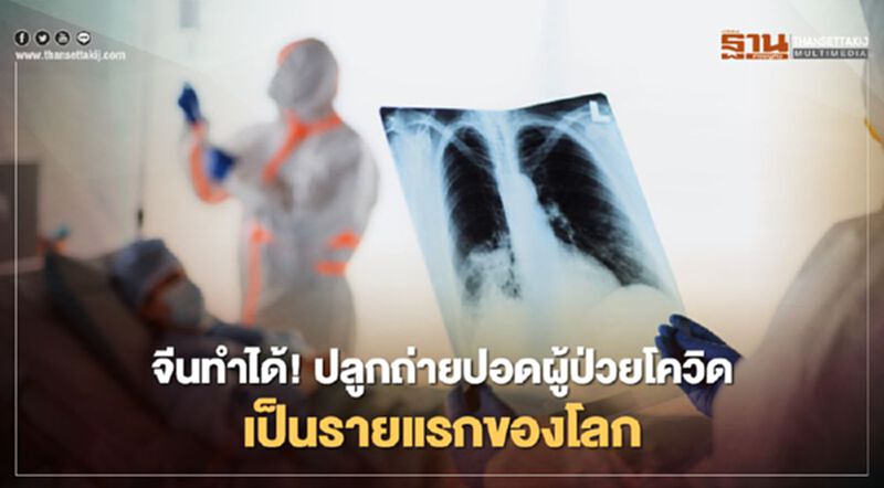 จีนทำได้! ปลูกถ่ายปอดผู้ป่วยโควิดสำเร็จเป็นรายแรกของโลก จีนทำได้! ปลูกถ่ายปอดผู้ป่วยโควิดสำเร็จเป็นรายแรกของโลก