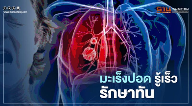 “มะเร็งปอด” รู้เร็ว รักษาทัน “มะเร็งปอด” รู้เร็ว รักษาทัน