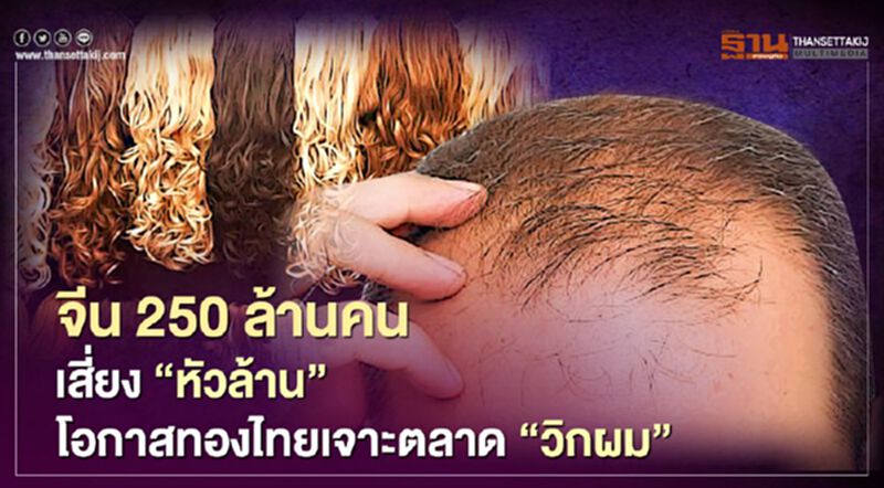จีน 250 ล้านคนเสี่ยง “หัวล้าน” โอกาสทองไทยเจาะตลาด “วิกผม” จีน 250 ล้านคนเสี่ยง “หัวล้าน” โอกาสทองไทยเจาะตลาด “วิกผม”