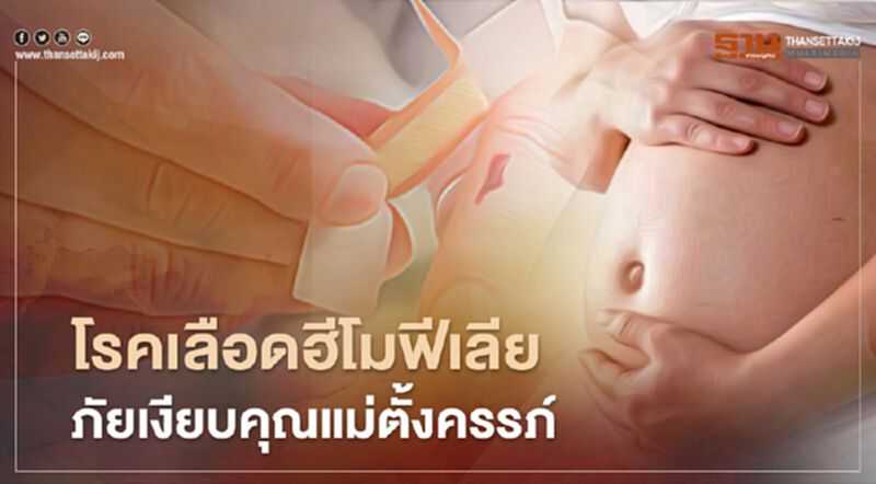 โรคเลือดออกง่ายฮีโมฟีเลีย ภัยเงียบคุณแม่ตั้งครรภ์ โรคเลือดออกง่ายฮีโมฟีเลีย ภัยเงียบคุณแม่ตั้งครรภ์