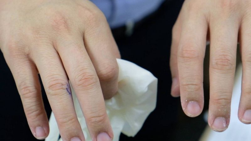  การยางฯจับมือม.อ.ตั้งศูนย์วิจัยสู้ ถุงมือยางธรรมชาติ"ไม่แพ้โปรตีน"