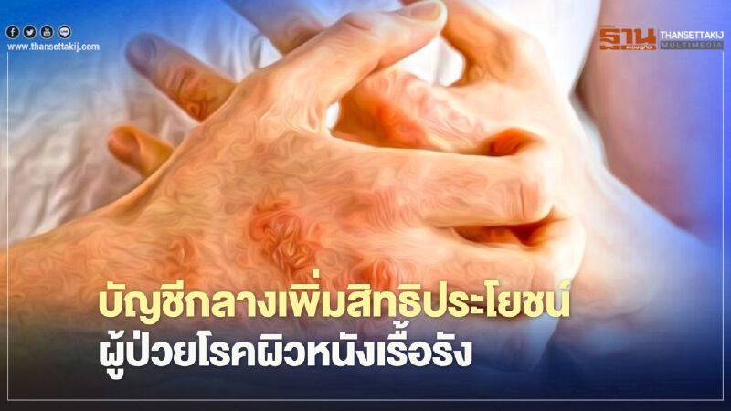 "ผู้ป่วยโรคผิวหนังเรื้อรัง"เช็กเลย กรมบัญชีกลางเพิ่มสิทธิประโยชน์ เริ่ม 15 ม.ค.นี้