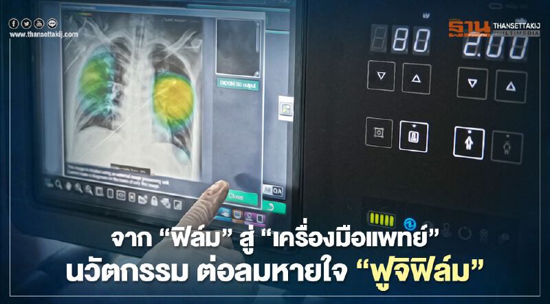 จากธุรกิจฟิล์ม สู่ “เครื่องมือแพทย์”  นวัตกรรม ต่อลมหายใจ “ฟูจิฟิล์ม”  