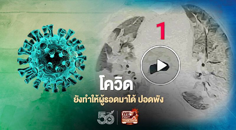 โควิด-19 ยังทำให้ผู้รอดมาได้ปอดพัง หมอนิธิพัฒน์ลังเลระลอกสามอาจรุนแรงกว่าเดิม โควิด-19 ยังทำให้ผู้รอดมาได้ปอดพัง หมอนิธิพัฒน์ลังเลระลอกสามอาจรุนแรงกว่าเดิม