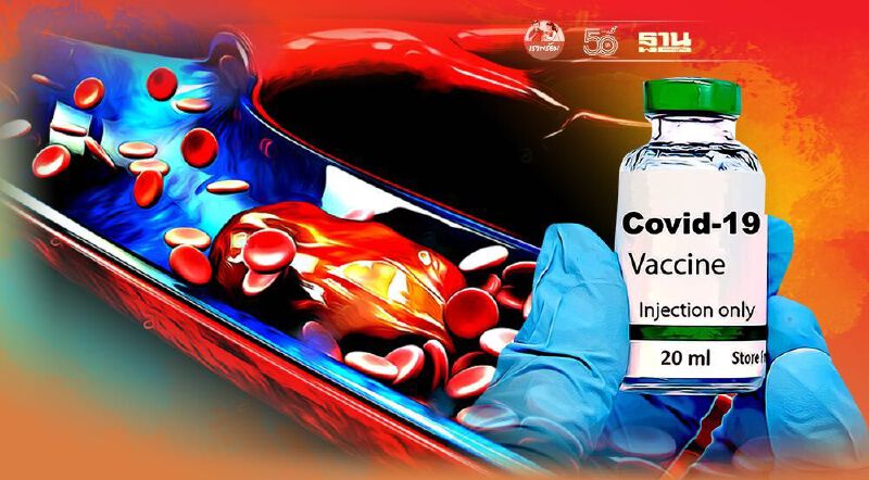 ลิ่มเลือดอุดตัน หลัง "ฉีดวัคซีนโควิด" อาการแบบไหน ต้องรีบพบแพทย์ 