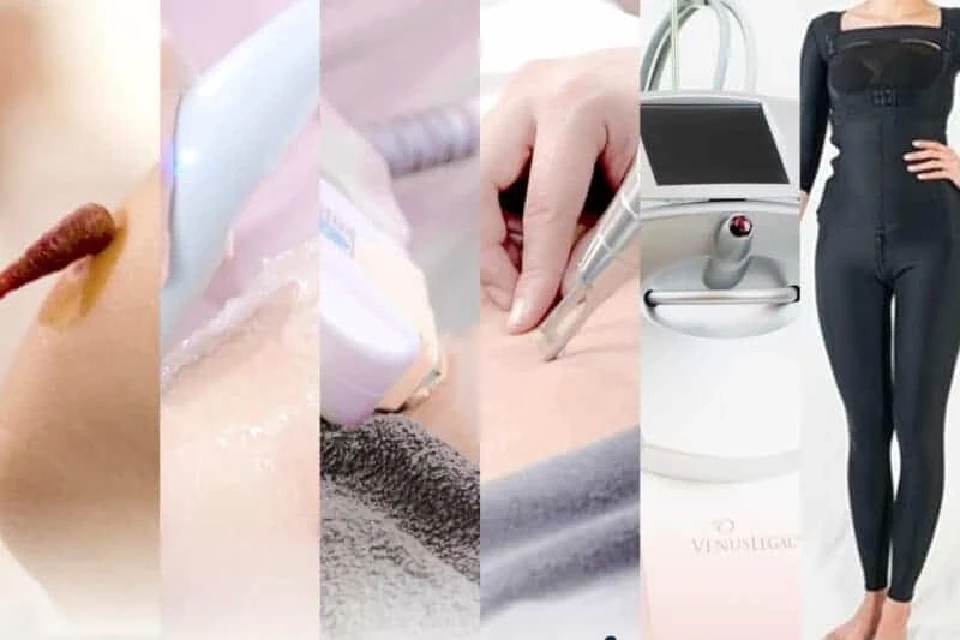 ดูดไขมันคืออะไร? หลังจากดูดไขมันเป็นอย่างไร