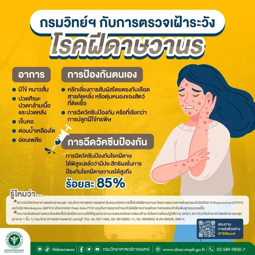 โรคฝีดาษวานร 
