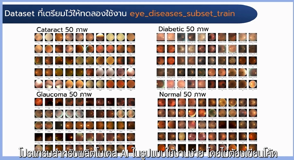 เปิด Medical AI Data Platform ตัวช่วยคัดกรอง-หมอวินิจฉัยโรครวดเร็ว
