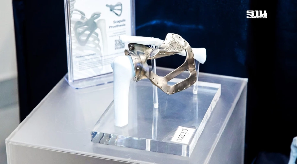 ครั้งแรกของโลก “รพ.ศิริราช” ผลิตกระดูกข้อสะโพกไทเทเนียม 3 มิติ