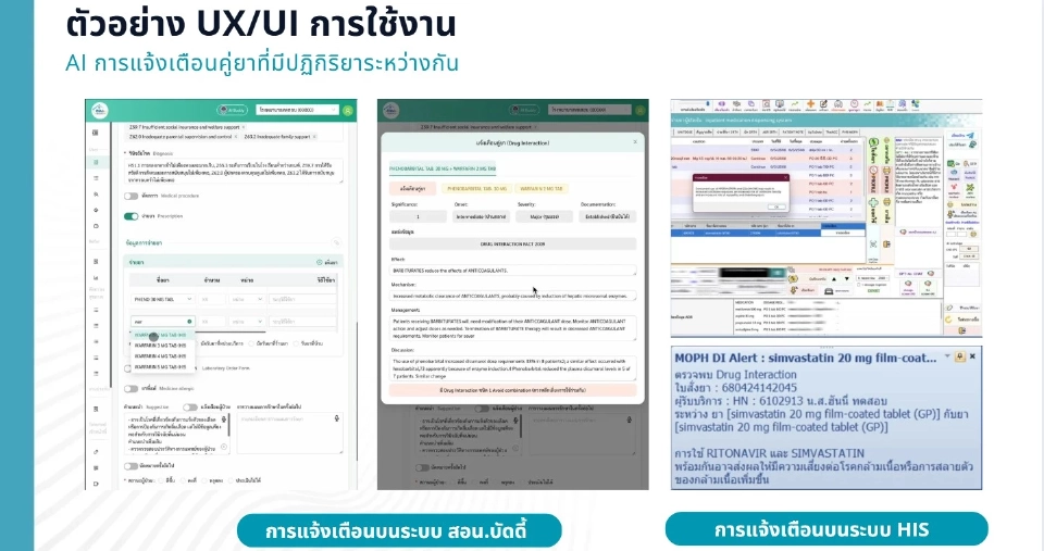 สธ. ขยายผลใช้ AI ตรวจจับคู่ยาอันตราย ช่วยแพทย์สั่งจ่ายยาปลอดภัย