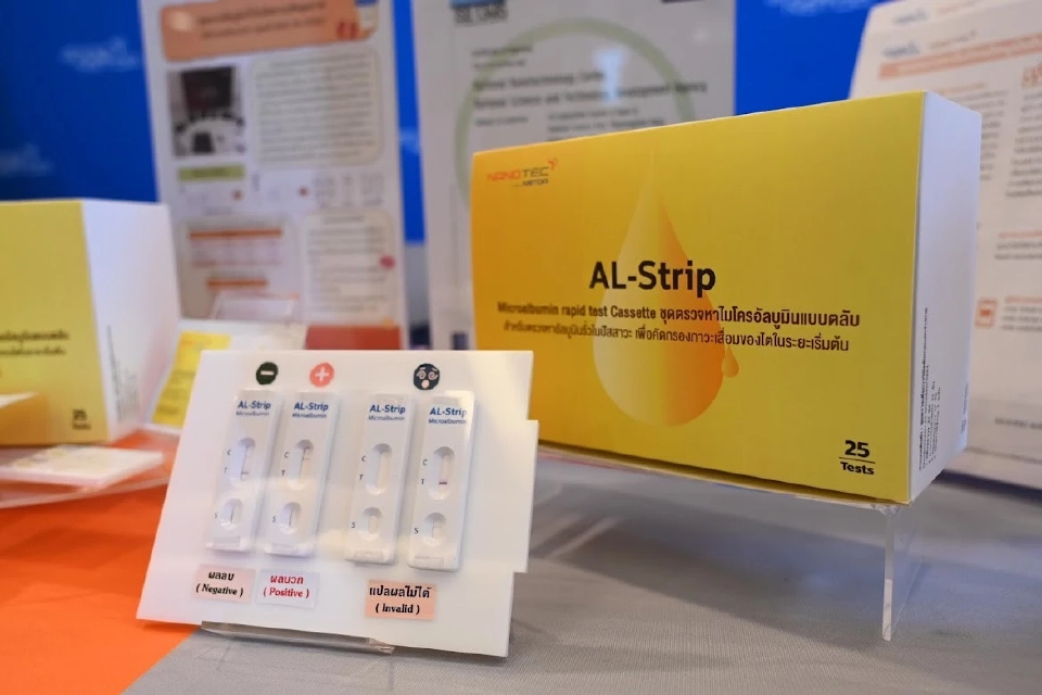 สวทช. นำร่อง "ขอนแก่นโมเดล" ใช้ชุดตรวจคัดกรองโรคไต รู้ผลใน 5 นาที