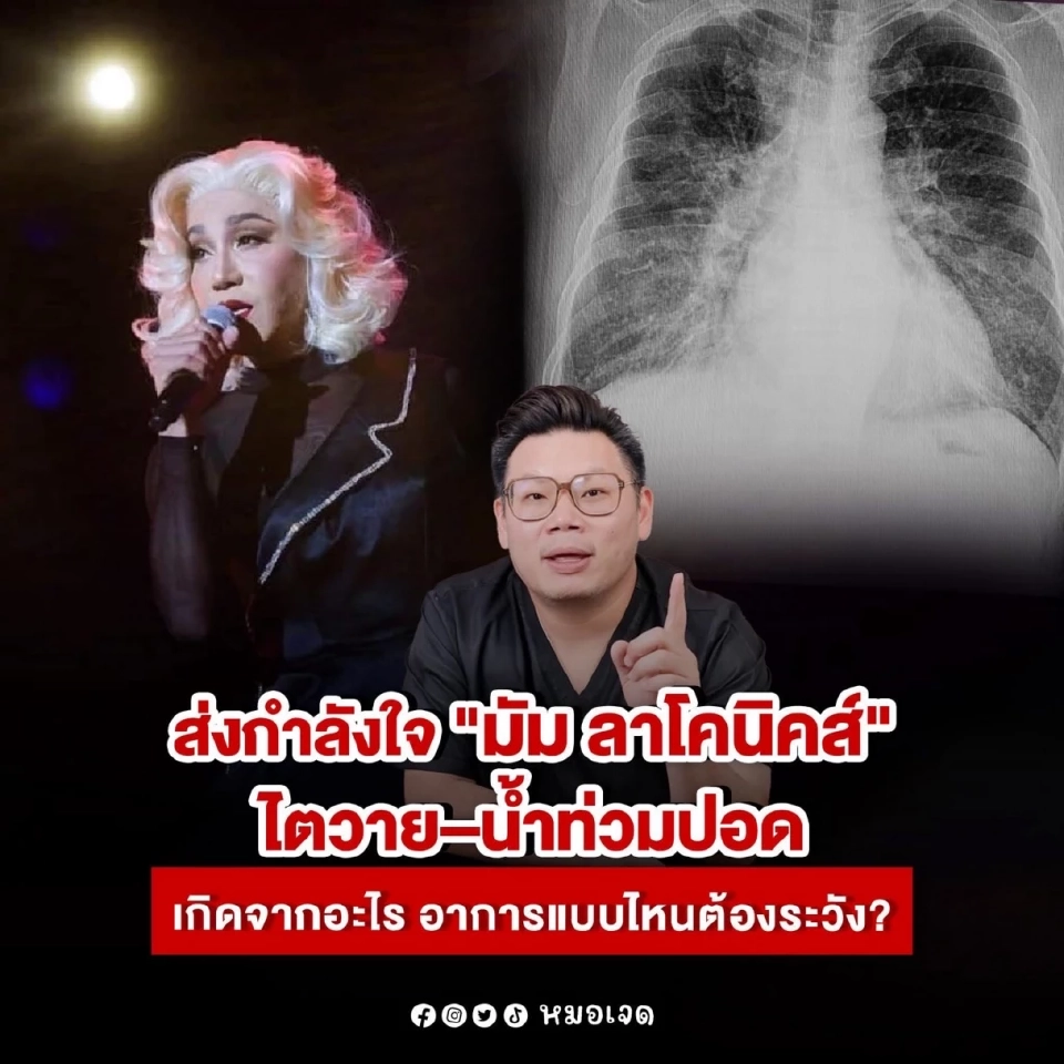 อาการไตวาย "มัม ลาโคนิคส์"