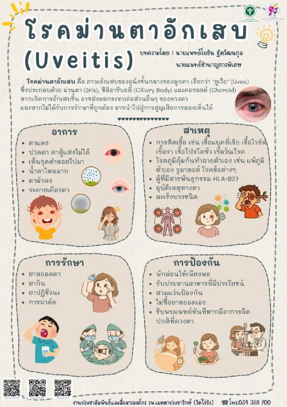 ปวดตา แพ้แสง มองไม่ชัด สัญญาณเตือน “ภาวะม่านตาอักเสบ”