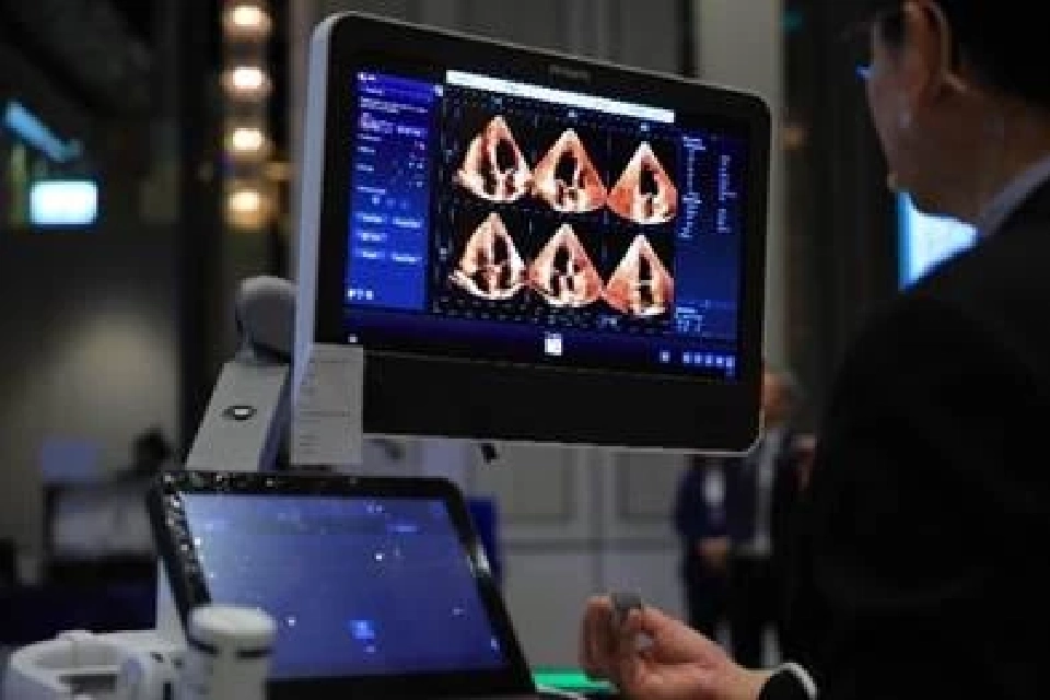 ฟิลิปส์ชู 3D Echo ยกระดับวินิจฉัยโรคหัวใจ รับวันหัวใจโลก