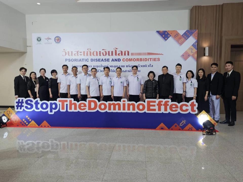 'โรคสะเก็ดเงิน' กระทบสุขภาพ รักษาตรงจุด หยุดโรคร่วมลุกลาม