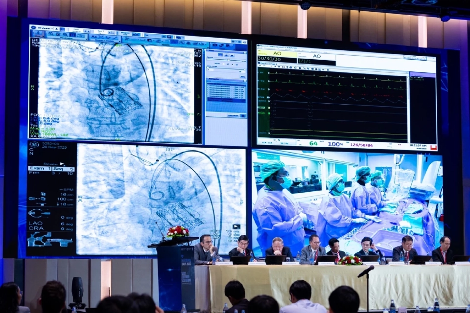 ยกระดับสาธารณสุขไทยด้วย ‘ลิ้นหัวใจเทียม’ นวัตกรรมรักษาโรคหัวใจและหลอดเลือด