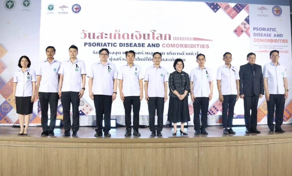 'โรคสะเก็ดเงิน' กระทบสุขภาพ รักษาตรงจุด หยุดโรคร่วมลุกลาม