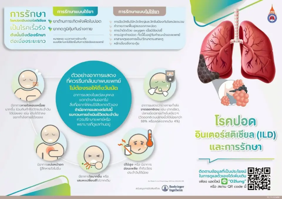 รังสีวิทยาสมาคมฯ-พันธมิตรยกระดับวินิจฉัยสู้ภัยโรคไอแอลดี