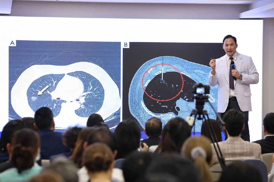 'พญาไท 1' เปิดยุทธศาตร์ ชูเทคโนโลยีชวนคนไทยตรวจ 'มะเร็งปอด'