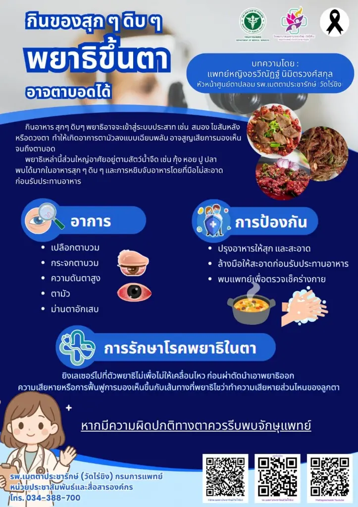 กรมการแพทย์เตือน เลี่ยงอาหารดิบ ป้องกันพยาธิขึ้นตา เสี่ยงตาบอด