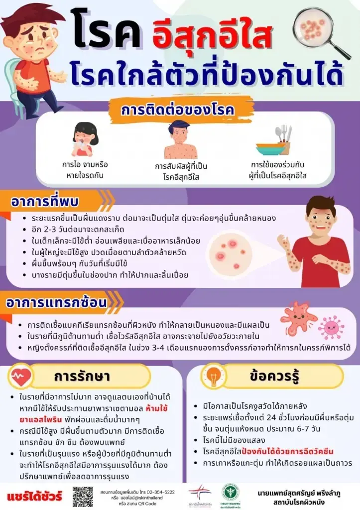 รัฐศาสตร์ มธ. สั่งเรียนออนไลน์ 3–6 มี.ค. พบอีสุกอีใสระบาดในหมู่นักศึกษา