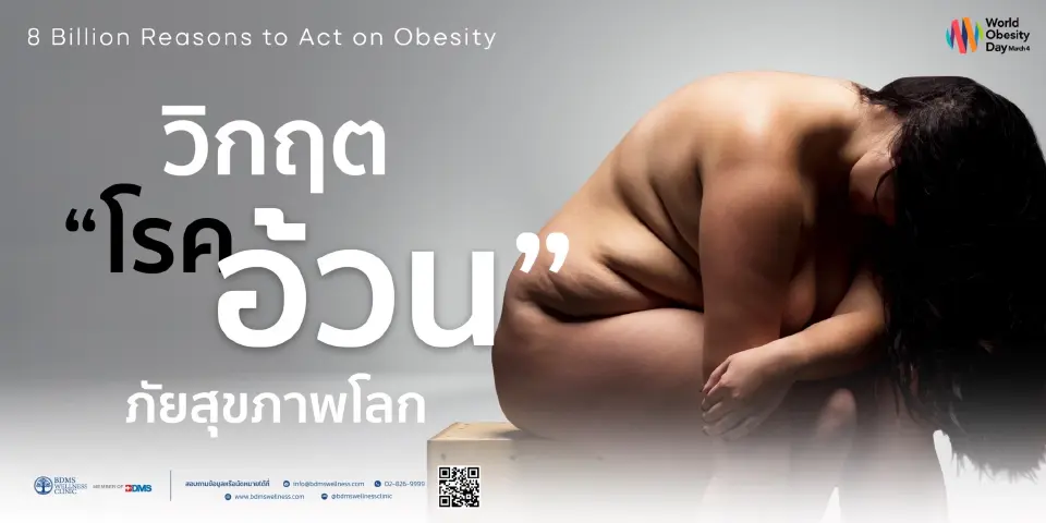 โรคอ้วนเขย่าเศรษฐกิจ-งบสาธารณสุข แนะภาครัฐเร่งสร้างสุขภาพยั่งยืน