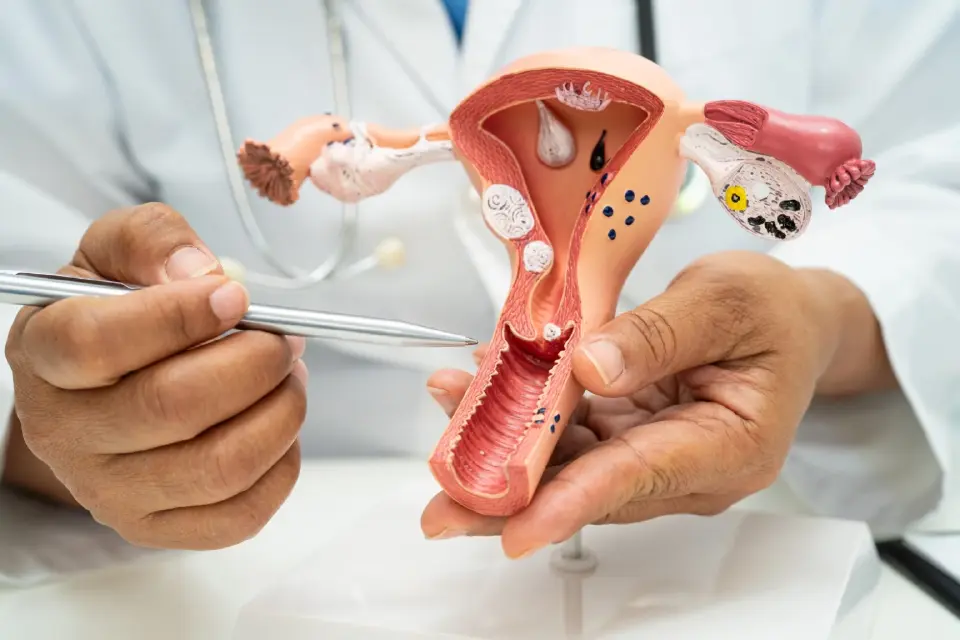 "เนื้องอกมดลูก" โรคยอดฮิตผู้หญิงยุคใหม่ สาเหตุและปัจจัยกระตุ้น