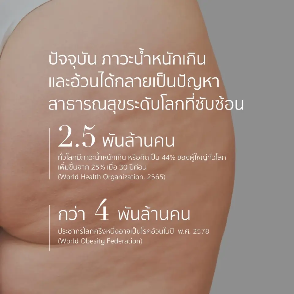 โรคอ้วนเขย่าเศรษฐกิจ-งบสาธารณสุข แนะภาครัฐเร่งสร้างสุขภาพยั่งยืน