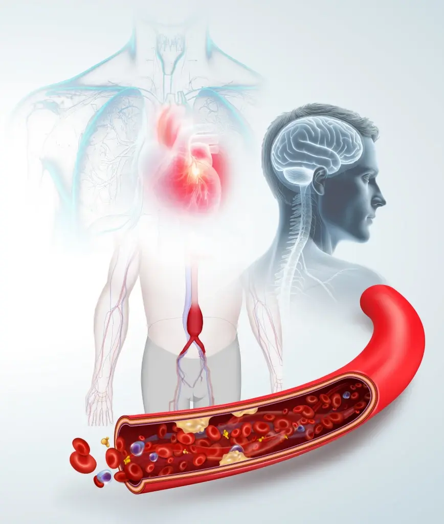 ระวังภัยเงียบ Sudden Death วัยทำงาน เสี่ยงเสียชีวิตกะทันหัน