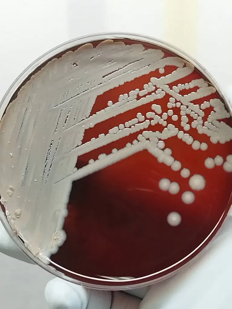 คนไทยป่วย โรคไข้ดิน พุ่ง กรมวิทย์ ชูตรวจแล็บครบวงจร รู้ผลไว ช่วยรักษาทันท่วงที