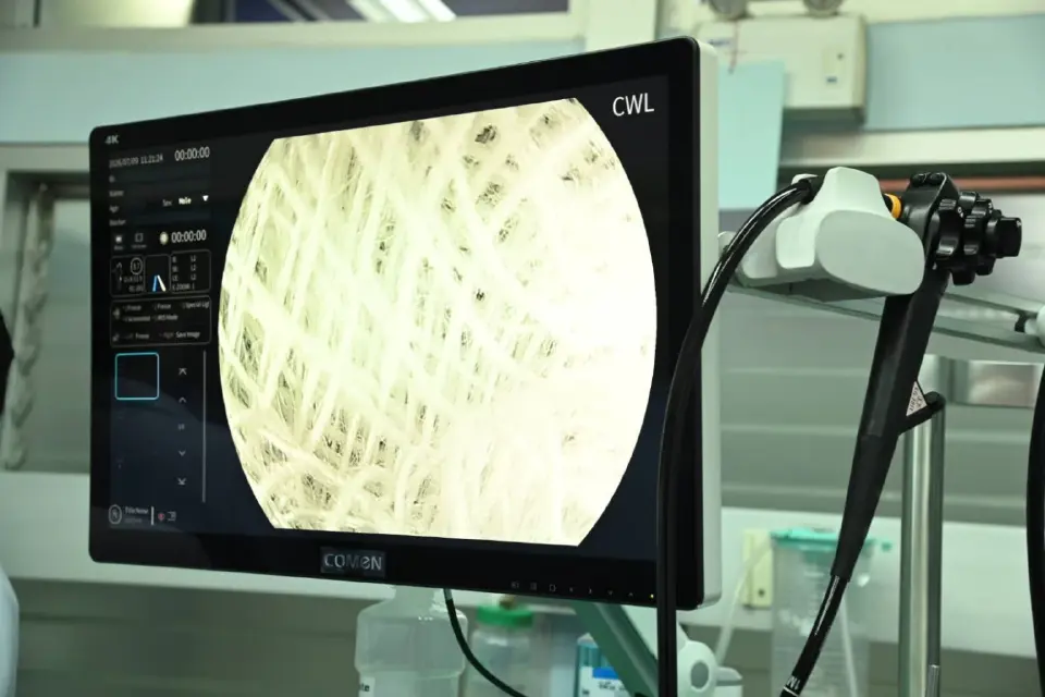 ศูนย์ส่องกล้อง Colonoscopy รพ.สรรพสิทธิประสงค์ และ รพ.ศรีสะเกษ 