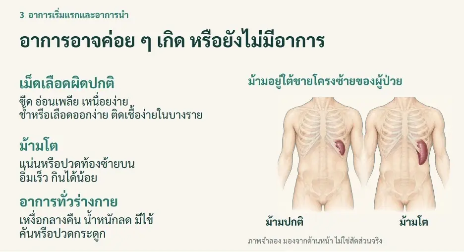 3 กลุ่มอาการเตือนที่มักถูกมองข้าม อาจนำไปสู่ “โรคพังผืดในไขกระดูก” (MF)