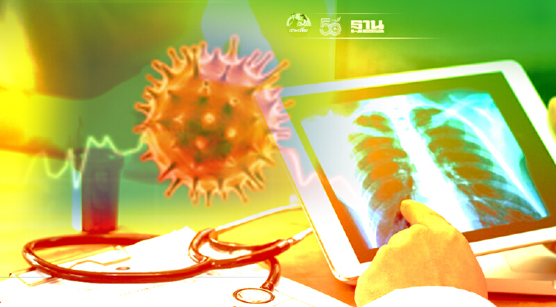 วิธีสังเกตปอดอักเสบจากโควิด หมอนิธิพัฒน์ชี้ไข้เกิน 38.5 นาน 2 วันเข้าข่าย