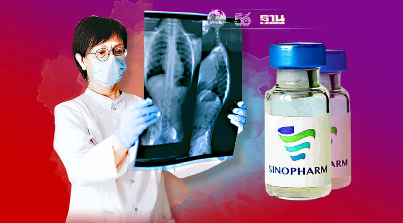 เปิดผลข้างเคียงหลังฉีด"วัคซีนซิโนฟาร์ม"มีอะไรบ้าง เช็คข้อมูลที่นี่